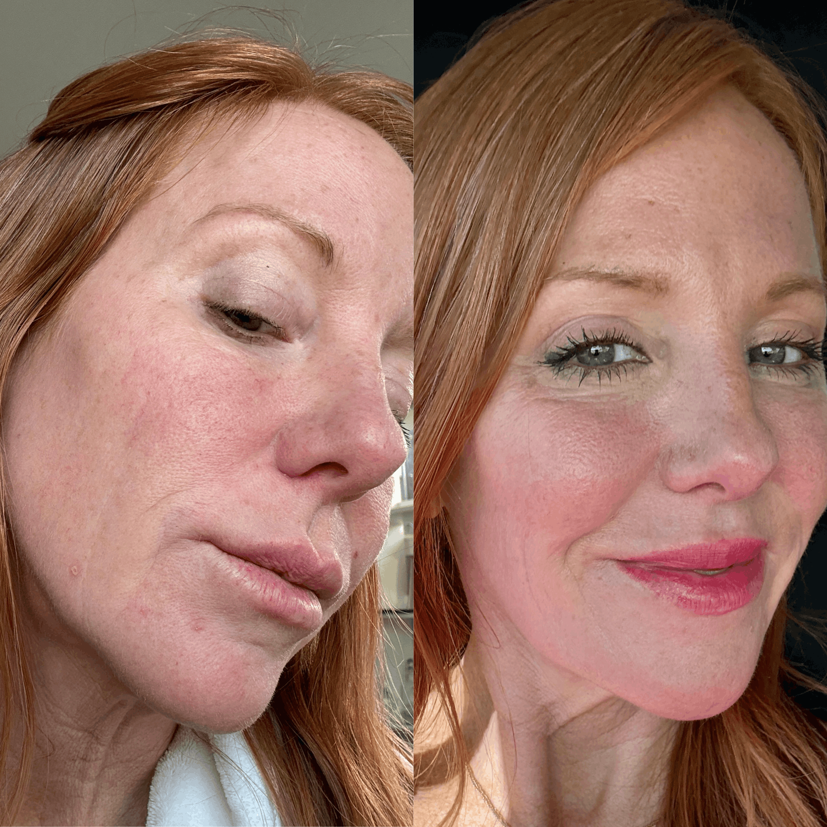 Wrinkle reduction